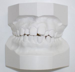 model dentar orto performance